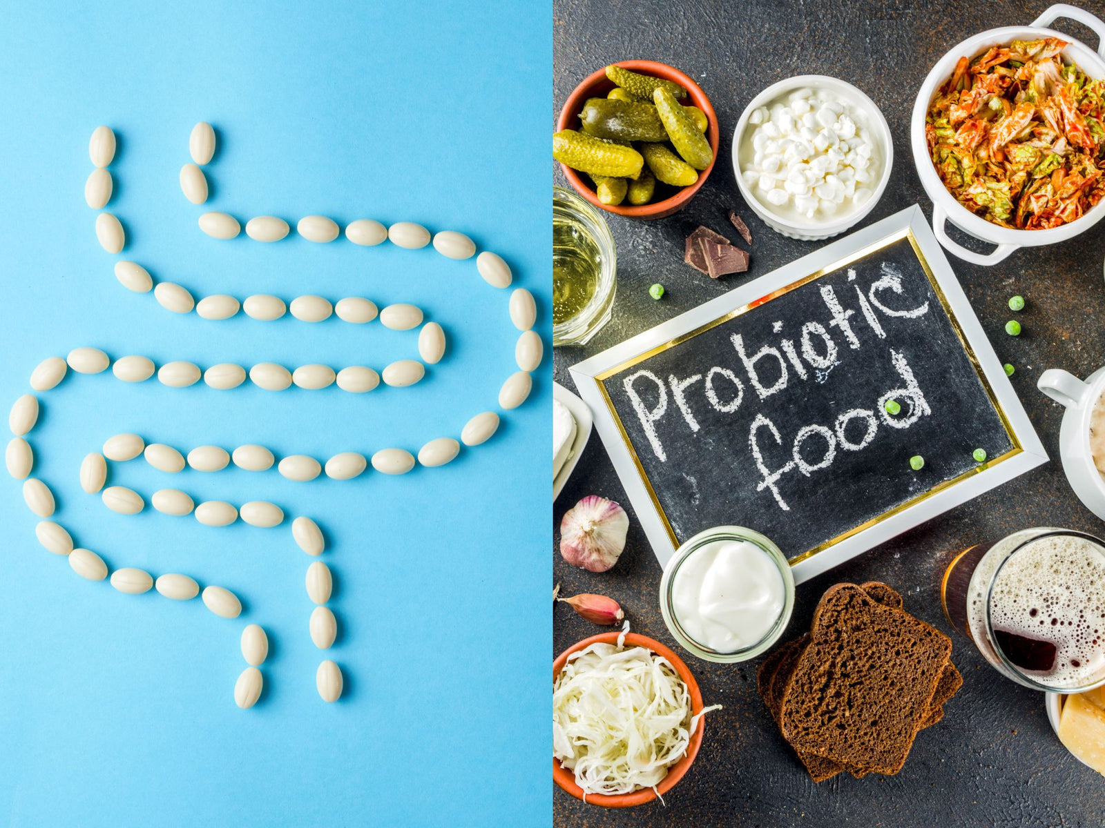Your gut. Is the perfect synergistic probiotic a pill or fermented food?